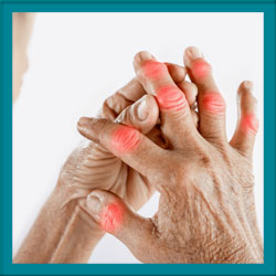 Gout Clinic